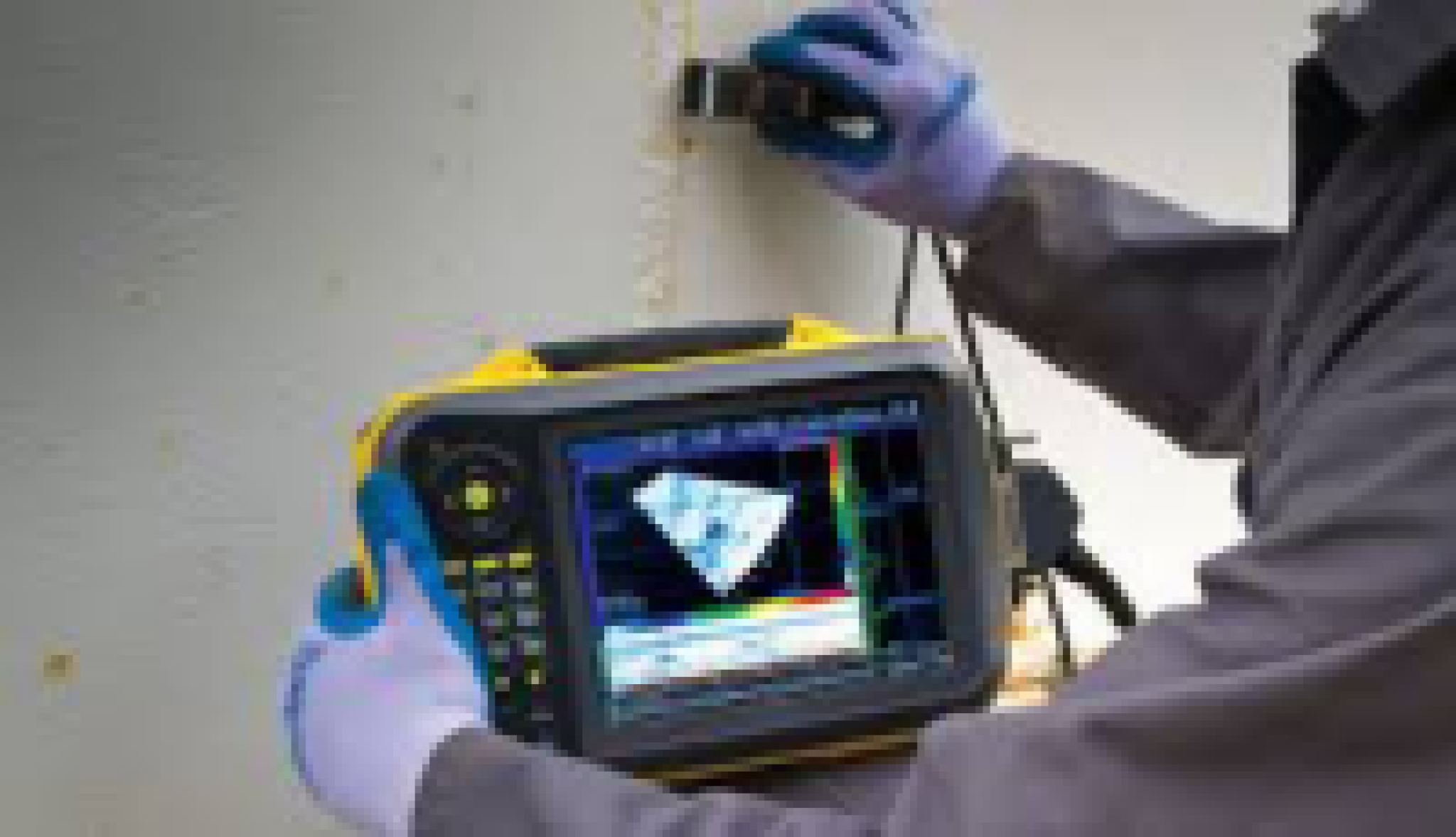 Imagerie obtenue par contrôle ultrasonore multiéléments